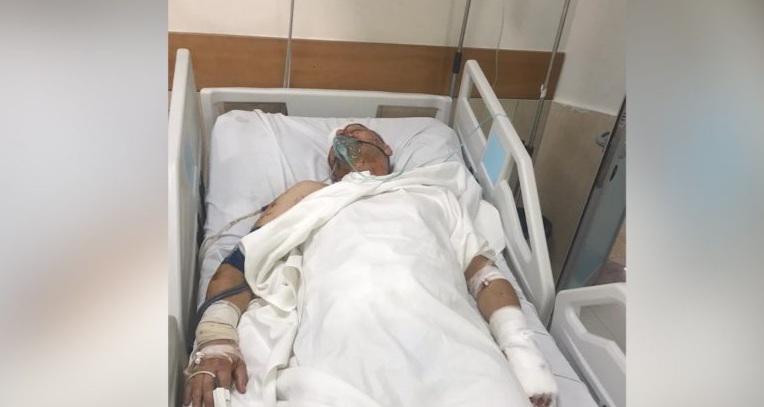 I MBIJETOI ATENTATIT ME TRITOL/ Preng Gjini flet nga spitali: Nuk janë në hasmëri dhe nuk ruhesha, kam lëvizur gjithë ditën në Tiranë