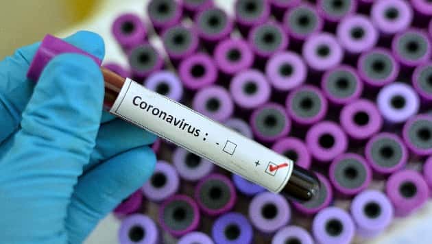 COVID HYN NË BURGUN E DRENOVËS/ Konfirmohen tetë të burgosur pozitivë me koronavirus