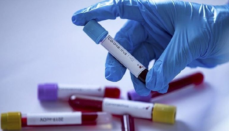 COVID-19/ Një mësues pozitiv në Maliq, karantinohen dy të tjerë