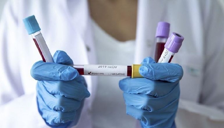 MAQEDONI E VERIUT/ Masat e reja kufizuese për parandalimin e përhapjes së Covid-19, ngecin në parlament