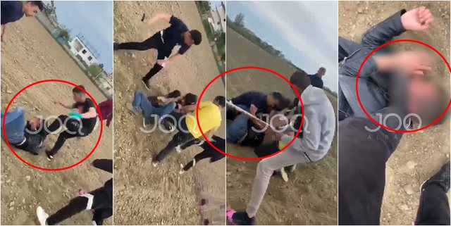 PAMJE TË RËNDA/ Adoleshentët rrahin bashkëmoshatarin me shqelma, grushte dhe çekiç kokës