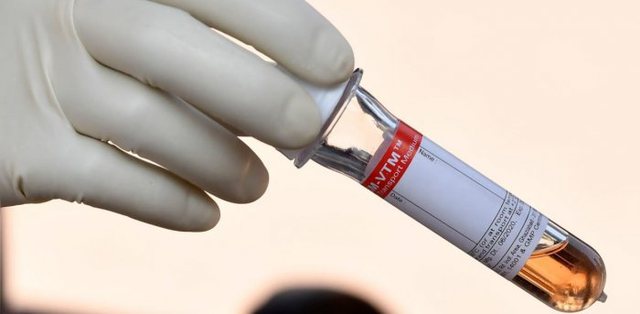 COVID/ Shkencëtarët zbulojnë testin më efektiv: Jep përgjigjen në 5 minuta, mund të përdoret…