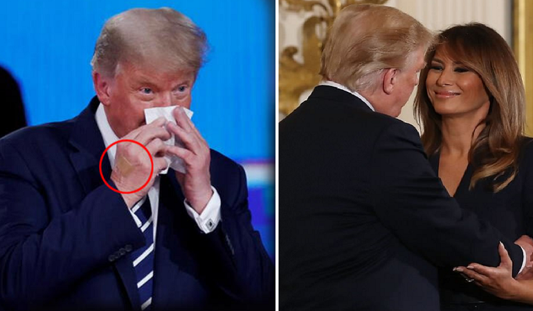 SHENJA E LËNË NGA COVID-19/ Kamerat kapin detajin në dorën e Donald Trump (PAMJET)