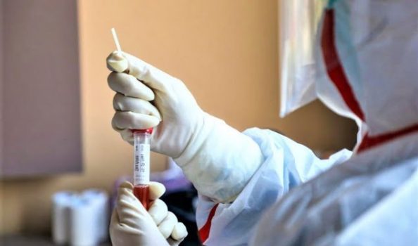 SITUATA E RËNDUAR E KORONAVIRUSIT/ Frikëson eksperti amerikan: Po vjen koha më e errët e pandemisë së COVID-19