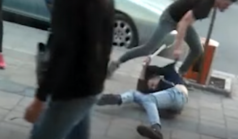 “MË PA SHTREMBËR”/ Përleshje me thika për një “shikim të ftohtë” mes të rinjve në Kamëz