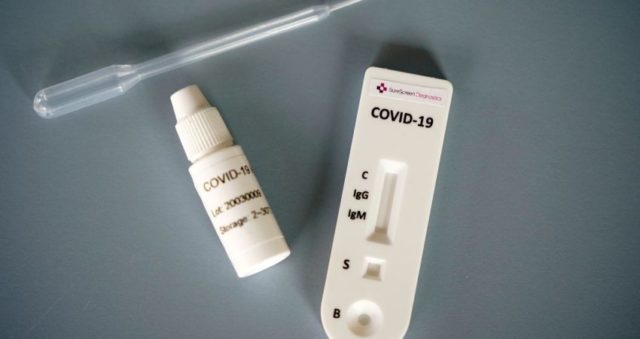 ÇUDIRA SHQIPTARE/ Laboratori në Koplik sfidon mjekësinë botërore: Teste për Covid në 10 minuta për 700 lekë