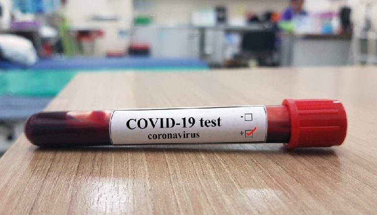 LUFTA NDAJ COVID-19/ Italia mungesë specialistësh, Austria futet në izolim të dytë