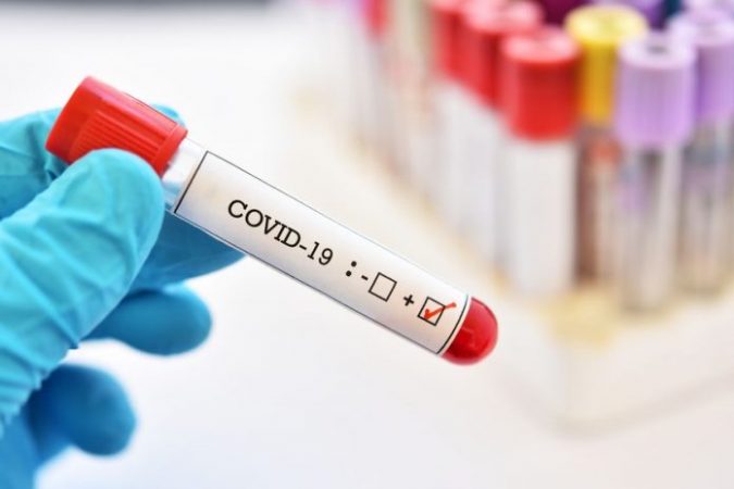 TESTI I COVID-19 I REZULTON POZITIV/ Gjobitet në Kakavijë një 65-vjeçar nga Elbasani