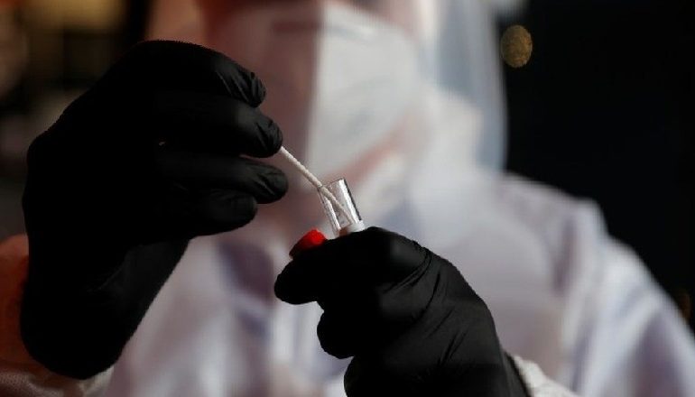 VARIANTI I RI I COVID-19/ Regjistrohet rasti i parë në SHBA