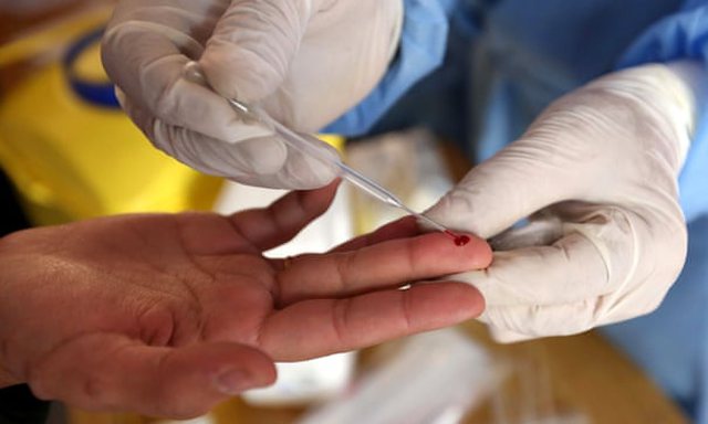 ZBULIMI I FUNDIT/ Një test gjaku mund të tregojë nëse një i infektuar me COVID do të mbijetojë apo jo