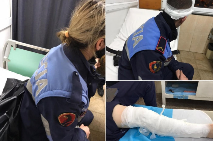 PROTESTA/ Djegie, plagë në kokë, sy e gjymtyrë te Trauma, dalin pamjet e policëve të dëmtuar