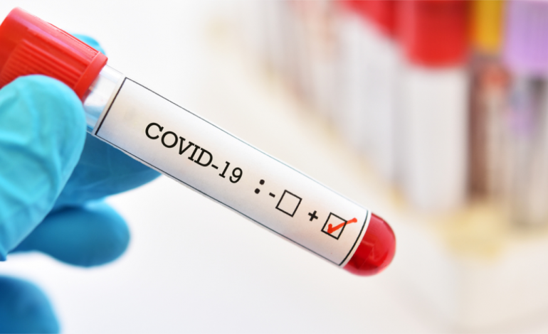 COVID-19 NË FIER/ Mjekja dhe infermierja e spitalit të fëmijëve të prekur, pozitive dhe një farmaciste e burgut