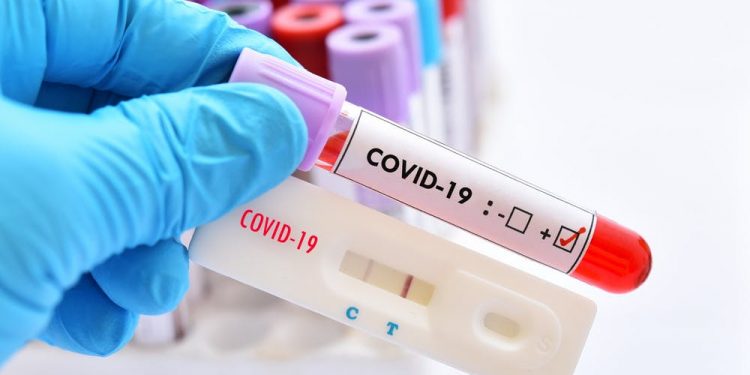 PANDEMIA NË SHQIPËRI/ Rreth 600 teste të shpejta në ditë në Tiranë dalin…
