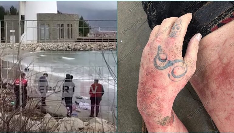 U GJET I PAJETË DJE NË BREGDET NË VLORË/ I riu ende i paidentifikuar. Me shenja dhune në kokë, tatuazhet që mund ta identifikojnë