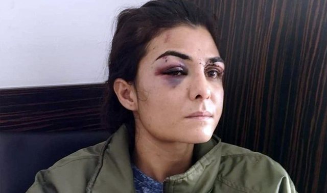 U TORTURUA DHE U PËRDHUNUA NË PRANGA/ 31-vjeçarja vret burrin dhe përballet me burgim të përjetshëm