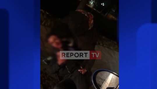 PAMJE TË RËNDA/ Siriani “masakron” me dhëmbë bashkëatdhetarin gjatë një sherri në mes të Tiranës (VIDEO)