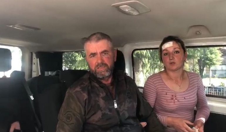 TË MBULUAR NGA GJAKU/ Dalin FOTOT e çiftit që u goditën me karrige nga vëzhguesi i PD në Maliq