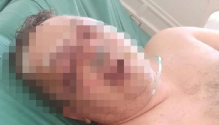 “PASHË NJË HIJE…”/ Rrëfehet polici grek i cili u rrah brutalisht nga 50-vjeçari shqiptar: Donte të më vriste