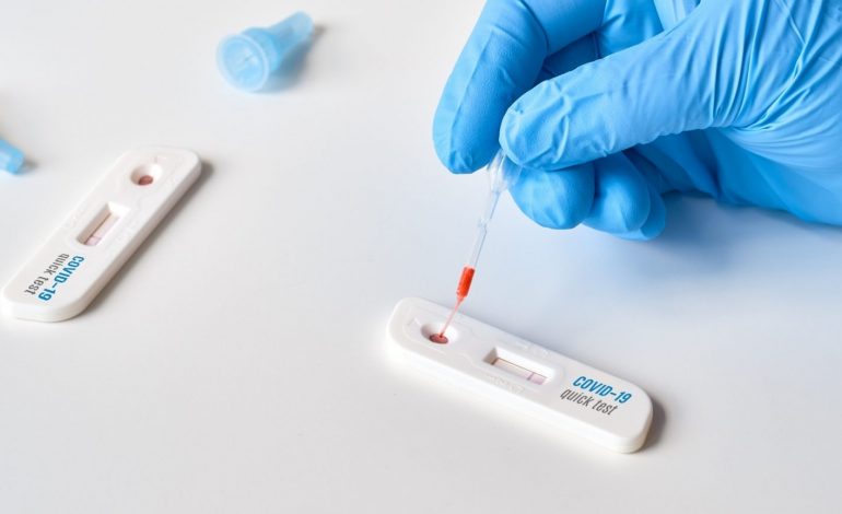 DO UDHËTONI DREJT RINASIT? TIA NJOFIM për pasagjerët: Tamponi PCR mund…