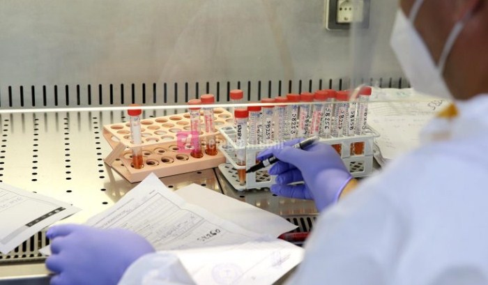 PANDEMIA NË KOSOVË/ Asnjë vdekje dhe 12 raste të reja në 24 orët e fundit