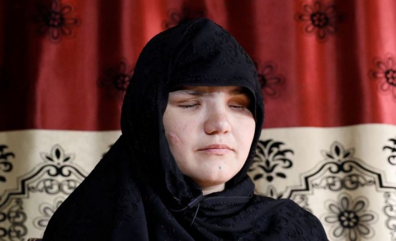 TALIBANËT I NXJERRIN SYTË/ 33-vjeçarja: Qentë do ushqehen nga mishi i grave në Afganistan