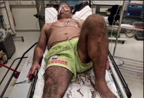 HERO/ Vrojtuesi shpëton nënë e bir nga mbytja në Spille, por vetë përfundon rëndë në spital