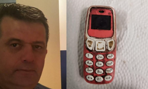 NDODH ÇUDIA/ I riu shqiptar gëlltit telefonin Nokia. Trondit doktori: Bateria mund të shpërthente
