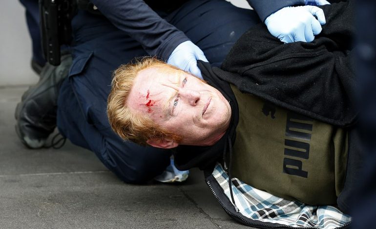 TË SHTRIRË NË TOKË DHE TË GJAKOSUR/ Policia qëllon plumba gome ndaj protestuesve që kundërshtojnë vaksinimin e detyruar
