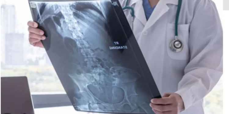 SHOKUESE/ Mjekët gjejnë në stomakun e pacientit mbi 1 kg vida dhe gozhda