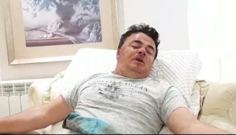 GRABITJA E BIZNESMENIT ÇANGU/ DETAJET: Policia aksion për kapjen e autorëve