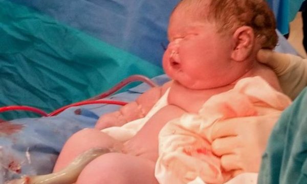 NDODH NË BRITANI/ Vjen në jetë foshnja 6.7 kg (FOTO)