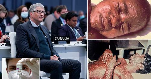 TRONDIT ME PARALAJMËRIMIN/ Bill Gates: Pandemia e lisë është “sulmi terrorist” i radhës