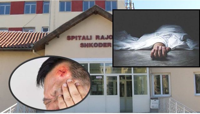 E RËNDË NË SHKODËR/ Shkon me dëmtime në kokë, ndërron jetë në spital qytetari