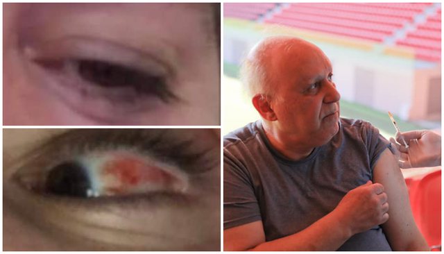 SËMUNDJA QË PO PËRHAPET NË SY/ Mjeku Kalo jep alarmin: Ruhuni jo vetëm nga Covid