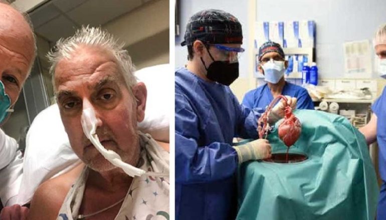 TRANSPLANTOI ZEMËR DERRI/ Kush është 57-vjeçari që tentoi të kryente një krim “pasioni” për dashurinë shumë vite më parë