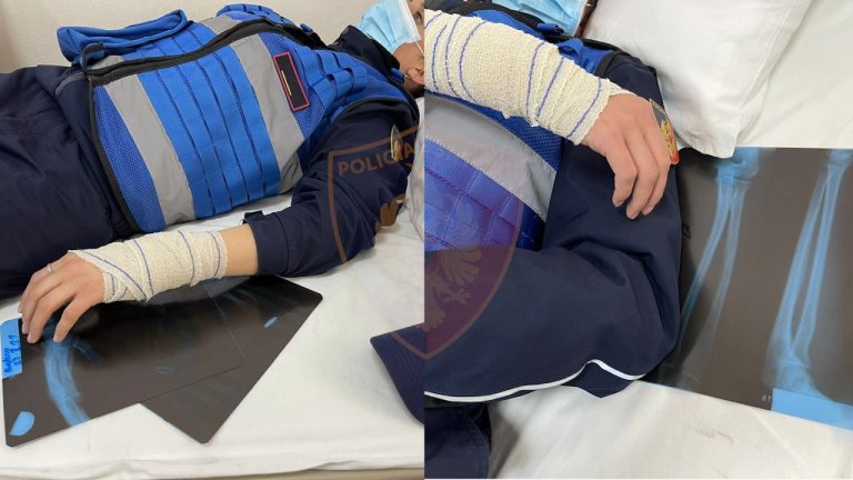 TENSIONET TEK “5 MAJI”/ Dëmtohen 8 efektivë, Policia: U goditën me sende të forta e lëndë djegëse