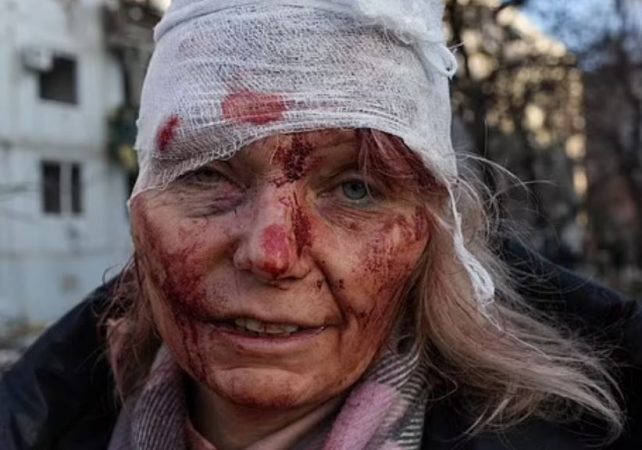 U PLAGOS RËNDË NGA SULMI RUS/ Kush është gruaja që u bë simbol i rezistencës ukrainase: Më kaloi vdekja para syve