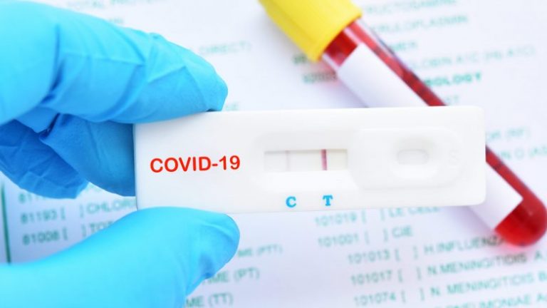 COVID-19 NË KOSOVË/ Regjistrohen 754 raste të reja dhew 8 viktima në 24 orët e fundit