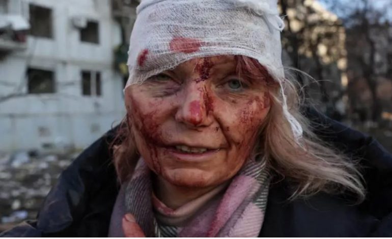 BOMBARDIMET RUSE NË UKRAINË/ Raportohet për shtatë viktima