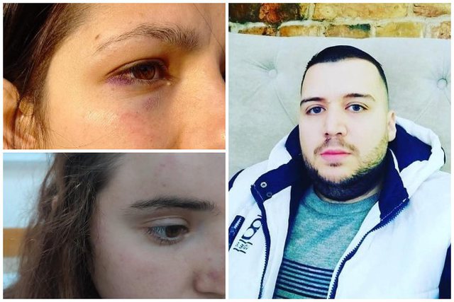 “KY ISHTE SULMI I DYTË”/ Flasin vajzat që u dhunuan në Tiranë: Ishim nisur për të bërë pazare kur…