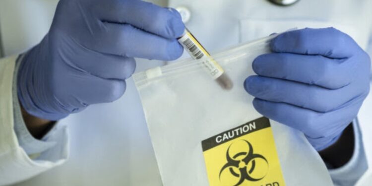 “URGJENTE”/ OBSH thirrje Ukrainës: Shkatërroni viruset në laboratorë para se të përhapen nga sulmet ruse