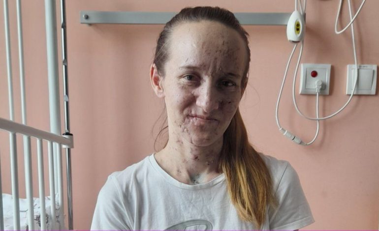 “ERDHËN NGA FERRI”/ Historia tragjike e nënës ukrainase me dy binjakët e saj, si i verboi bomba ruse që i shpërtheu në banesë