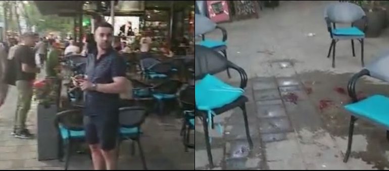 DEL VIDEO E SHERRIT/ Shqiptari përfundoi në spital pas sherrit me tifozët holandezë