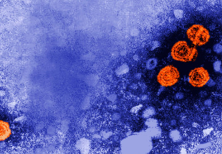 SHPËRTHIMI I HEPATITIT MISTERIOZ/ Shkencëtarët po studiojnë lidhjen mes infektimeve dhe kontaktit me qentë