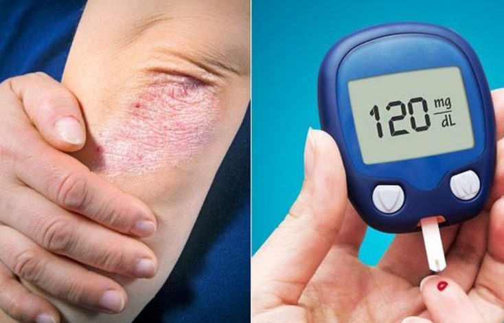 VËMËNDJE! Si ndryshojnë simptomat e diabetit tek gratë dhe burrat, çfarë duhet të dini