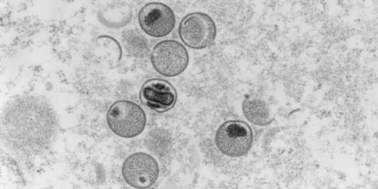 EMERGJENCA GLOBALE/ Ja si shpërtheu dhe u përhap lija e majmunëve në mbarë botën kaq shpejt