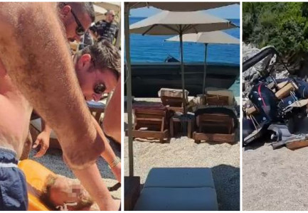 TË TJERA PAMJE/ Çifti që u përplas nga gomonia po qëndronin në breg, 31-vjeçari dëmtime në fytyrë e brinjë, ndërsa vajza…