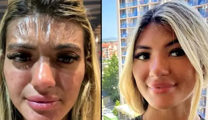 E ZURI GJUMI NË PLAZH PA KREM DIELLI/ E reja zgjohet me “ballin prej plastike”