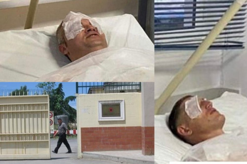 DETAJET E FUNDIT/ Uzina u sulmua nga dy rusë dhe një grua ukrainas, dyshimet e forta të SHISH janë se…