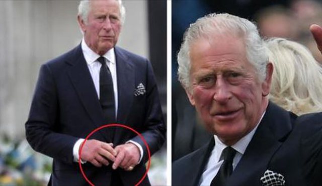 E PAPRITUR/ Gishta të skuqur dhe të fryrë, çfarë po ndodh me shëndetin e Mbretit Charles III?